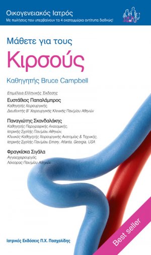 Μάθετε για τους κιρσούς