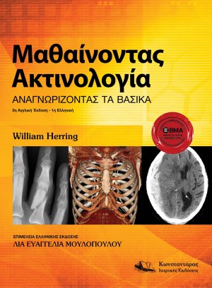 Μαθαίνοντας Ακτινολογία