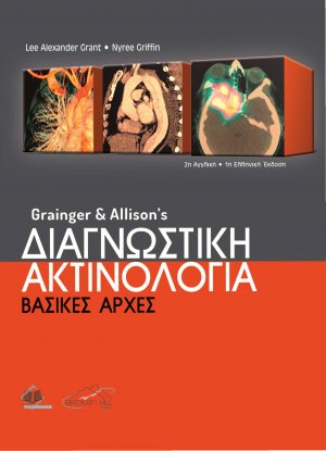 Grainger and Allison’s Διαγνωστική Ακτινολογία-Βασικές Αρχές
