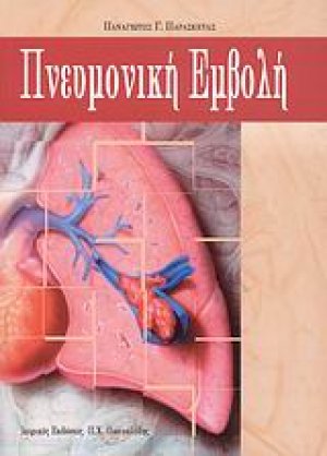 Πνευμονική εμβολή