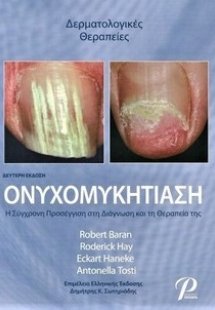 Ονυχομυκητίαση
