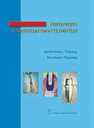 Χειρουργική οδοντικών εμφυτευμάτων