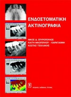 Ενδοστοματική ακτινογραφία