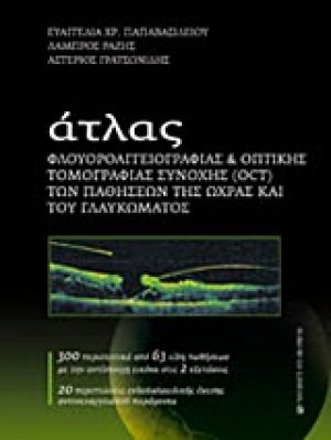 Άτλας φλουοροαγγειογραφίας και οπτικής τομογραφίας συνοχής (OCT) των παθήσεων της ώχρας και του γλαυκώματος