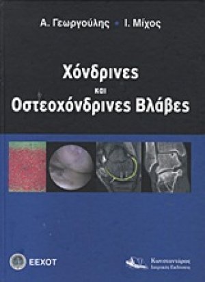Χόνδρινες και οστεοχόνδρινες βλάβες