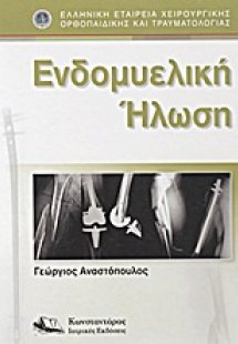 Ενδομυελική ήλωση