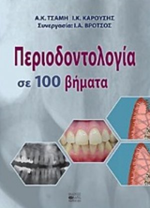 Περιοδοντολογία σε 100 βήματα