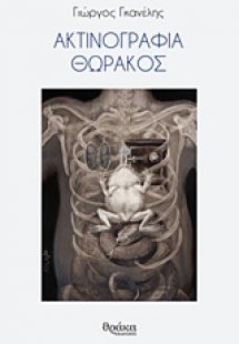 Ακτινογραφία θώρακος