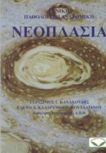 Νεοπλασία