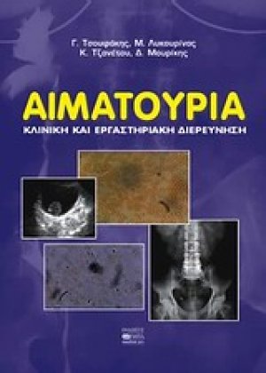 Αιματοουρία