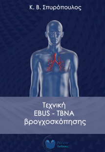 Τεχνική EBUS-TBNA βρογχοσκόπησης